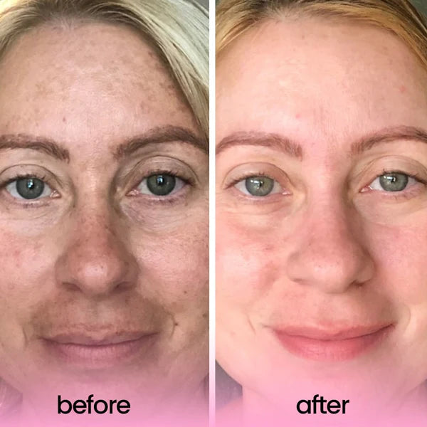 وسادات تنظيف حمض الكركم